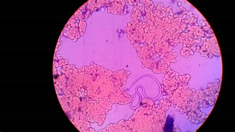  Yersiniose! Un parasite microscopique qui nous fait peur sans même qu’on le voie