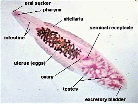  Clonorchis sinensis : Un parasite minuscule aux habitudes de vie fascinantes, se faufilant à travers l'intestin et laissant une trace mémorable !