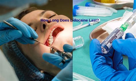 How Long Does Lidocaine Spray Last: A Journey Through Time and Numbness